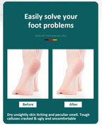 High-Quality Stainless Steel Foot File Double Sided Callus Remover For Dead Skin Professional Pedicure Tools Callous Scraper