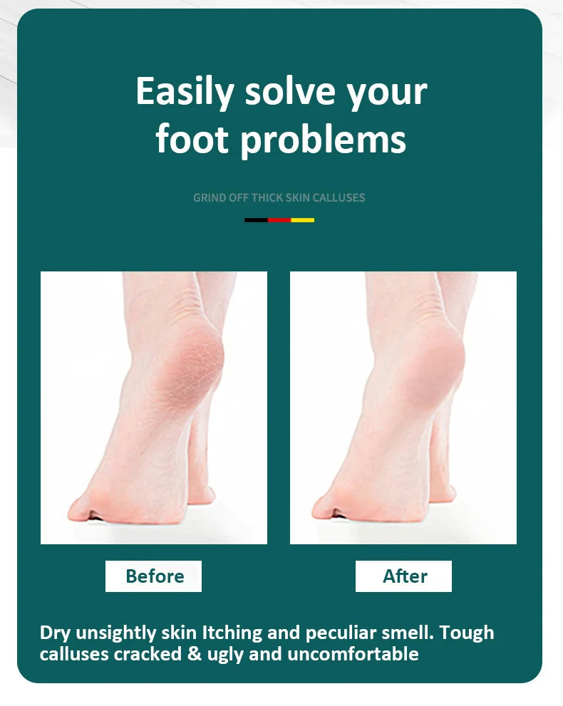 High-Quality Stainless Steel Foot File Double Sided Callus Remover For Dead Skin Professional Pedicure Tools Callous Scraper