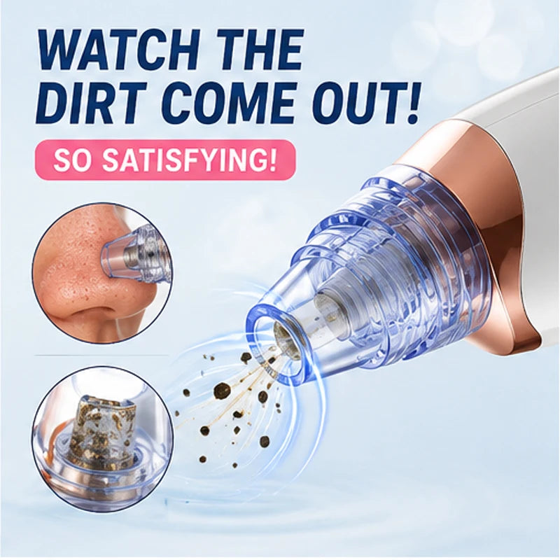 Professional Pore Vacuum Blackhead Remover Deep Cleaning Facial Acne Oil Control Skin Care Device