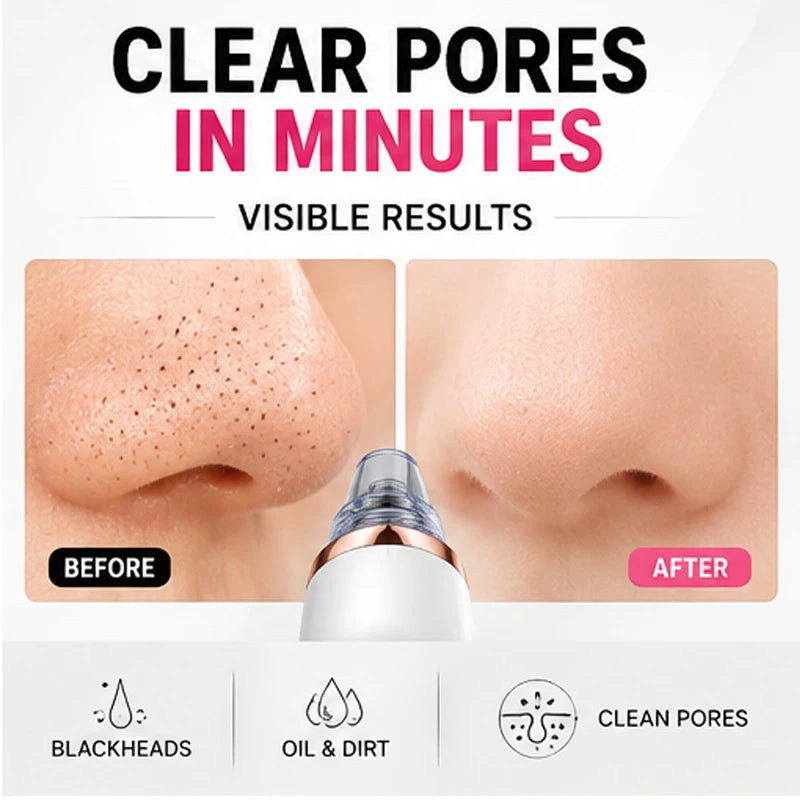 Professional Pore Vacuum Blackhead Remover Deep Cleaning Facial Acne Oil Control Skin Care Device