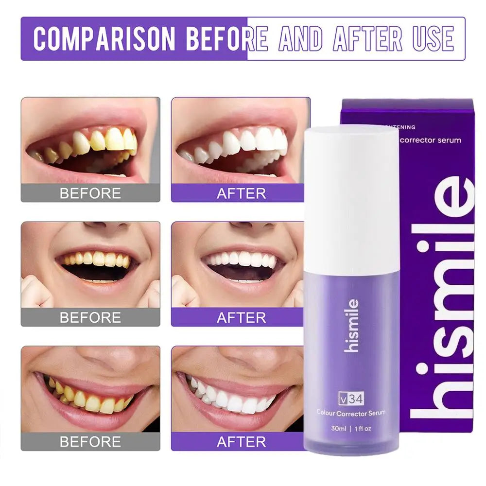 Hismile V34 Colour Corrector Serum 30ml Original Professional Purple Toothpaste Remove Tooth Stains Enhance Tooth Whiten Effect